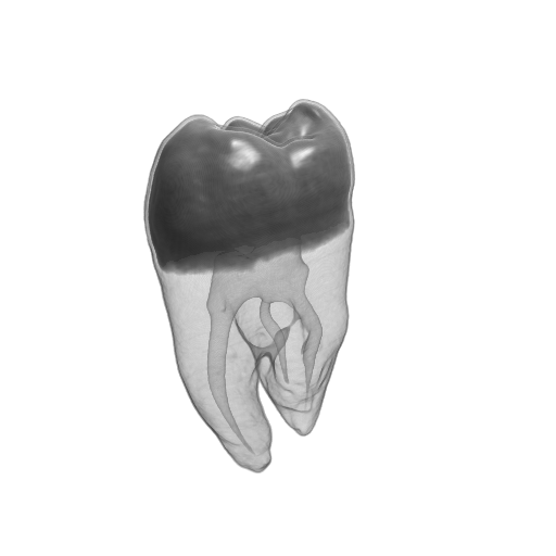 Tooth dataset: reconstructed image